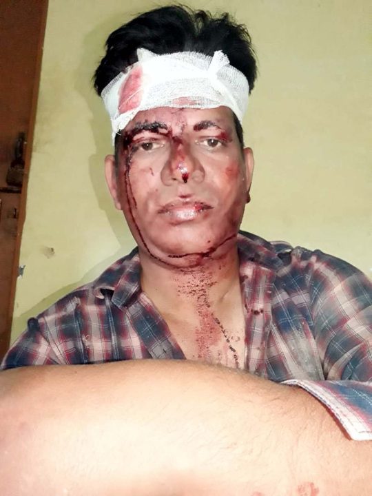 जिम संचालक पर मारपीट कर आभूषण व पैसे लूटने के आरोप