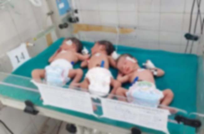 बेतिया में महिला ने एक साथ तीन बच्चों को दिया जन्म