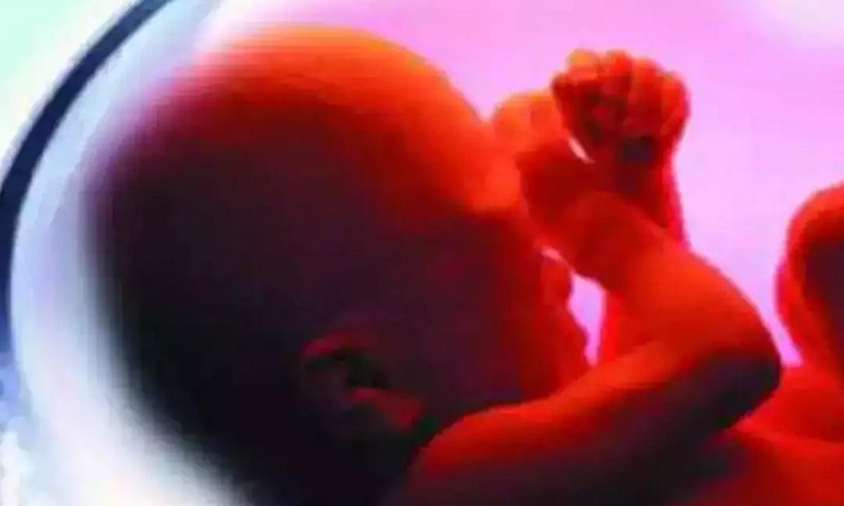 कूड़ेदान में मिला कन्या भ्रूण, अस्पताल सील