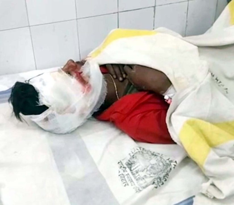 ट्रक और ऑटो की टक्कर में दो की मौत, एक घायल
