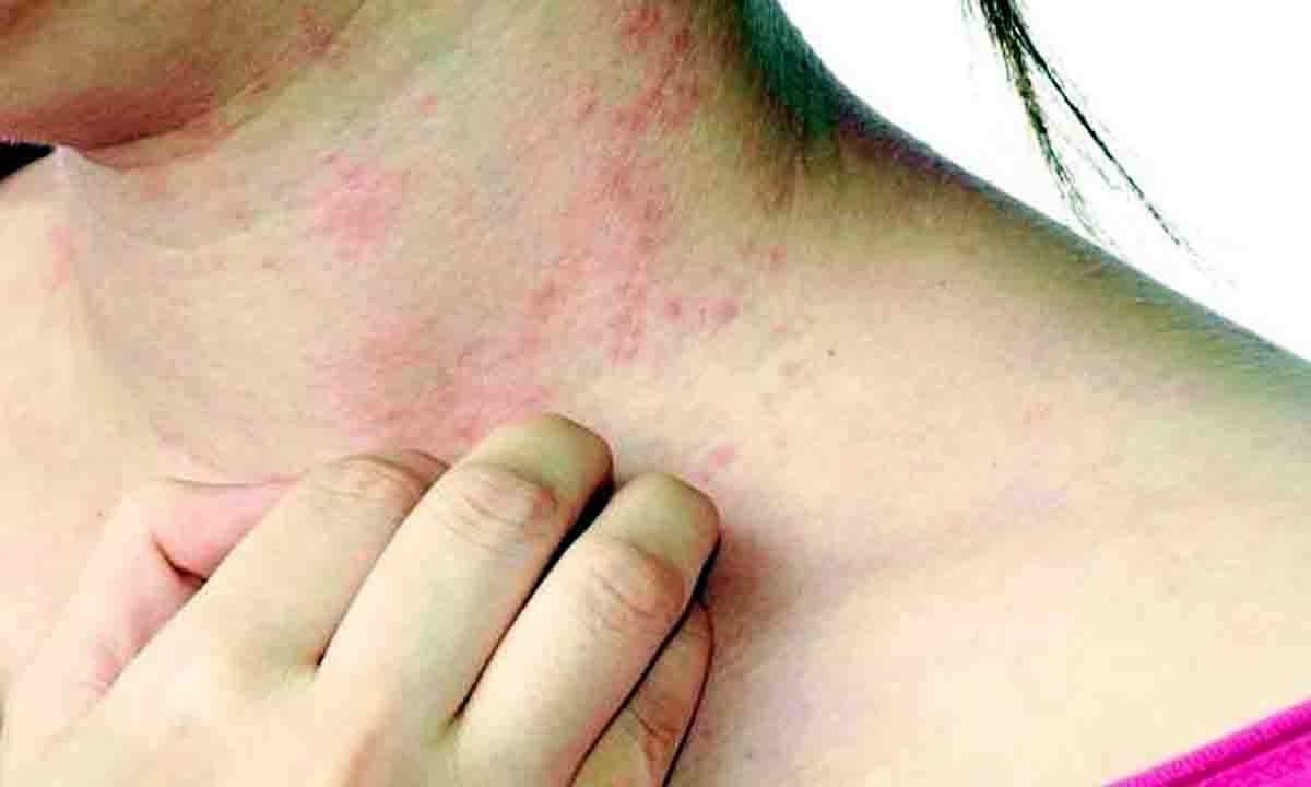 बॉडी के पर लाल रंग के डॉट तो जाने क्या हो सकती है वजह