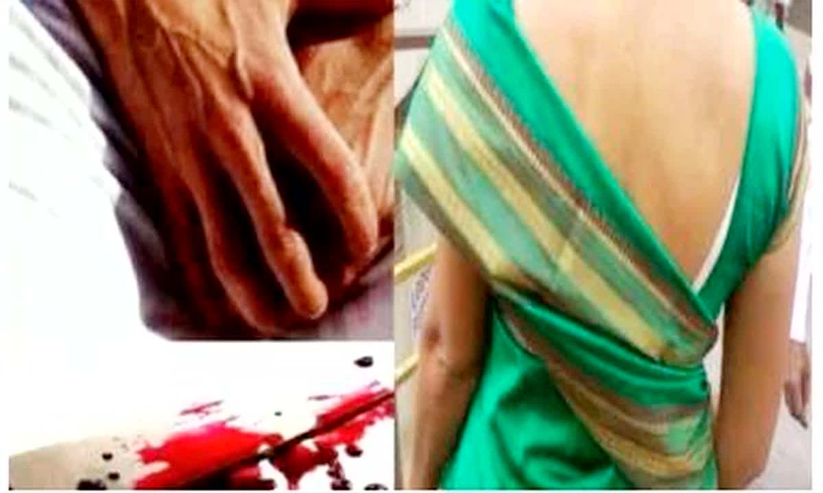 शाहजहाँपुर में विवाद के बाद महिला के गुप्तांग पर किया सरिया से हमला, गंभीर घायल