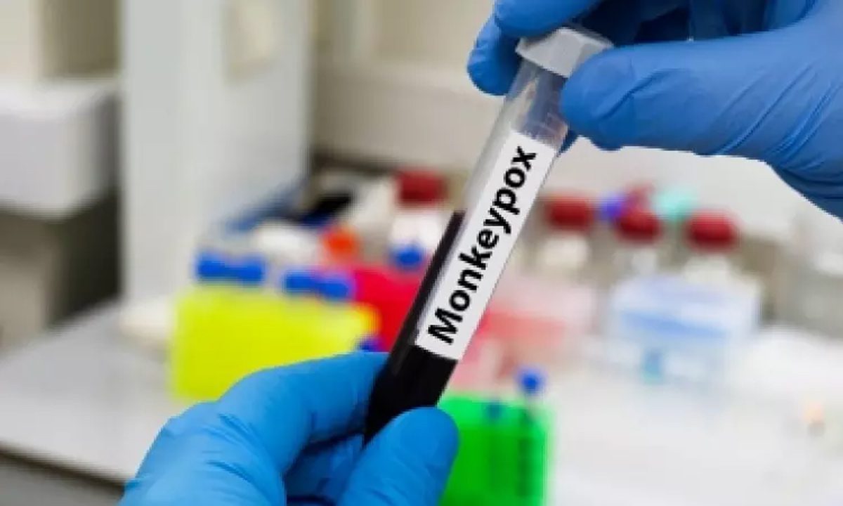 Mpox: 26 देशों से 906 नए मामले दर्ज