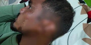 Meghalaya : ईजेएच गांव के नेताओं पर कुल्हाड़ी से हमला