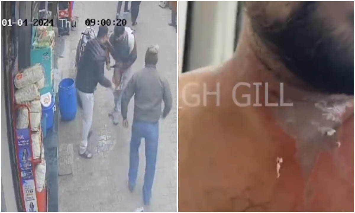 Miscreants threw acid on the shopkeeper, watch LIVE VIDEO of the incident